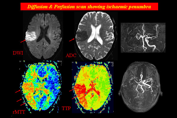 download analyses concerning passive